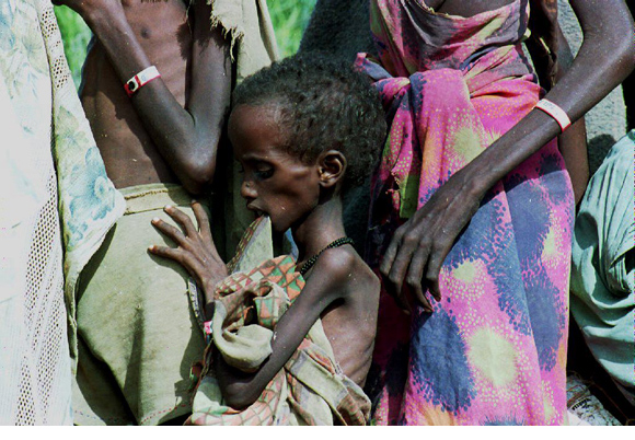somalia-starving